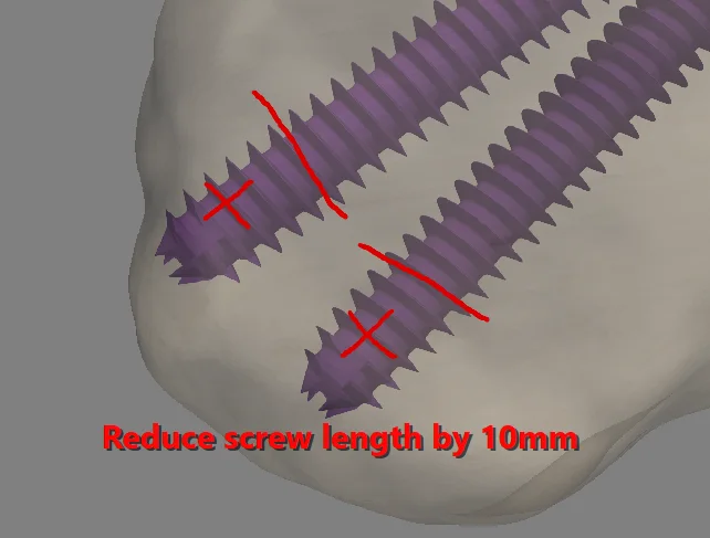 Three-dimensional implant view annotated with redline instructions