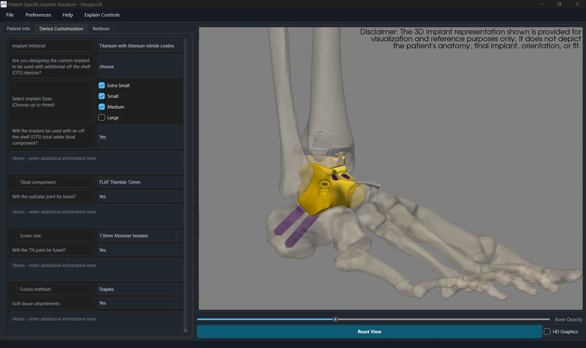 Patient-Specific Implant Visualizer interface with a dynamic form and interactive three-dimensional model