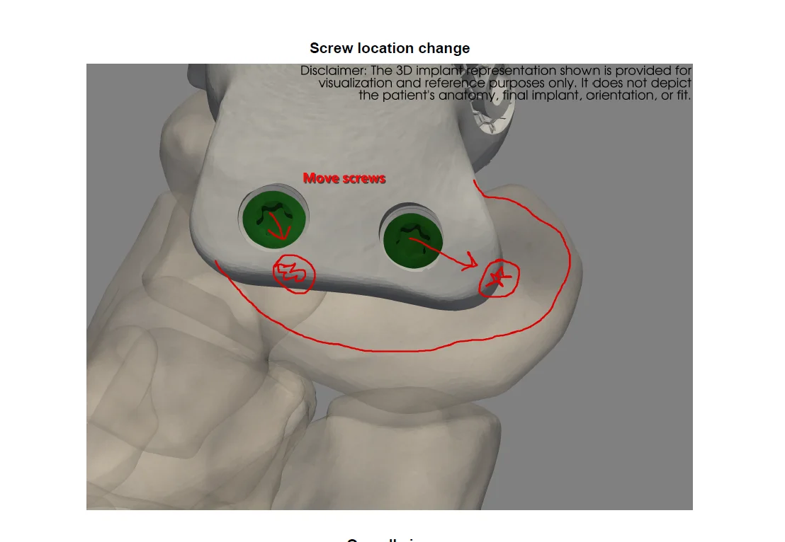 Exported PDF page containing an annotated implant view